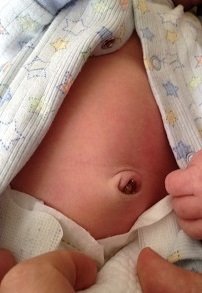 2015-03-18 - The Belly Button